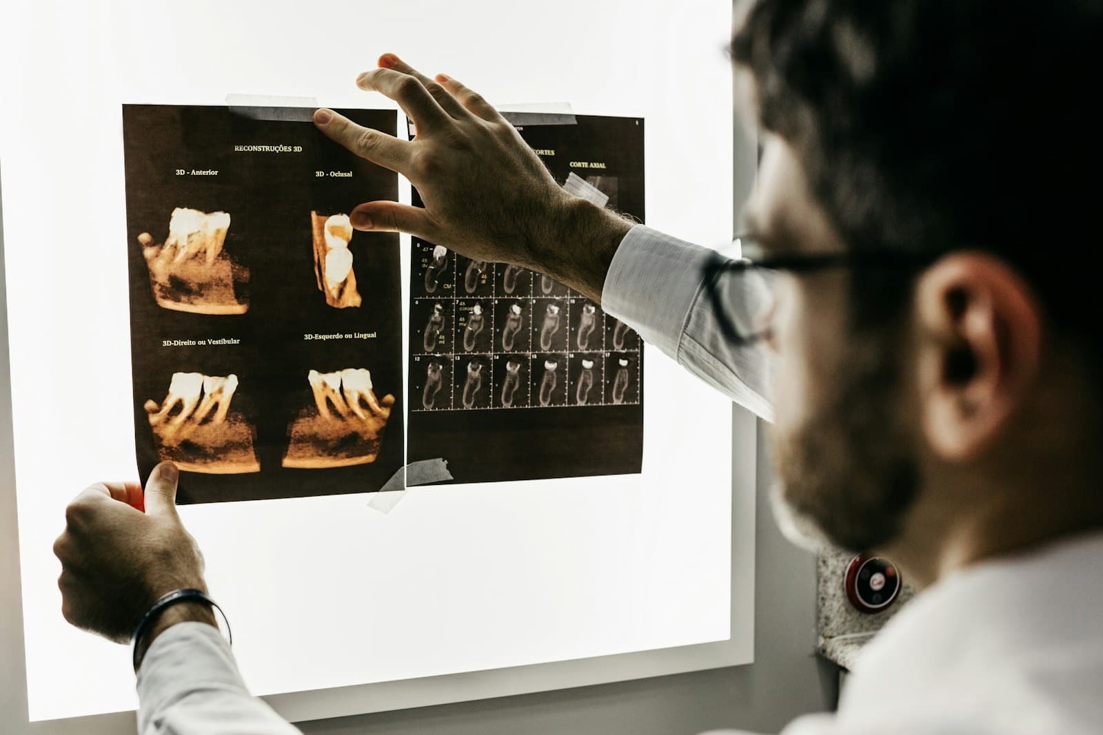 Specialisten bekijken een 3D-scan op het scherm